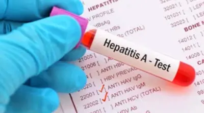 Apakah Penyakit Hepatitis Akut Menular?