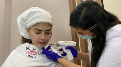 Cantik 24 Jam Dengan Messo V Shape dan Infus Whitening