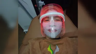 Enyahkan Flek Hitam dengan Tekhnologi Laser Glass Skin