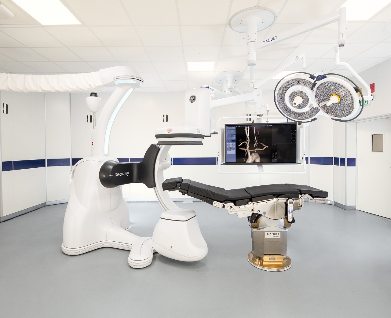 Operasi Bentall pada Diseksi Aorta dapat Dilakukan di Heartology Cardiovascular Center