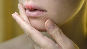 Bibir pucat sebagai tanda wajah kurang vitamin - Womanindonesia.co.id