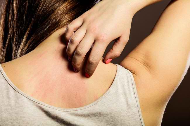 Mendeteksi Alergi Obat Dalam Tubuh Kita