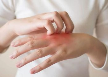 Mengatasi Penyakit Kulit dan Mengenali Penyebabnya