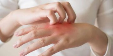 Mengatasi Penyakit Kulit dan Mengenali Penyebabnya