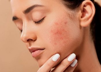 Hati-hati Memakai Skincare yang Gatal di Kulit, Kenali Penyebabnya