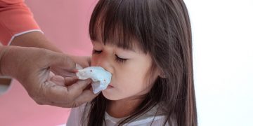 Anak Sering Mimisan Apa Penyebabnya?