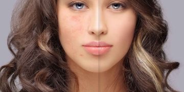 10 Bahaya Merokok Bagi Kesehatan Kulit