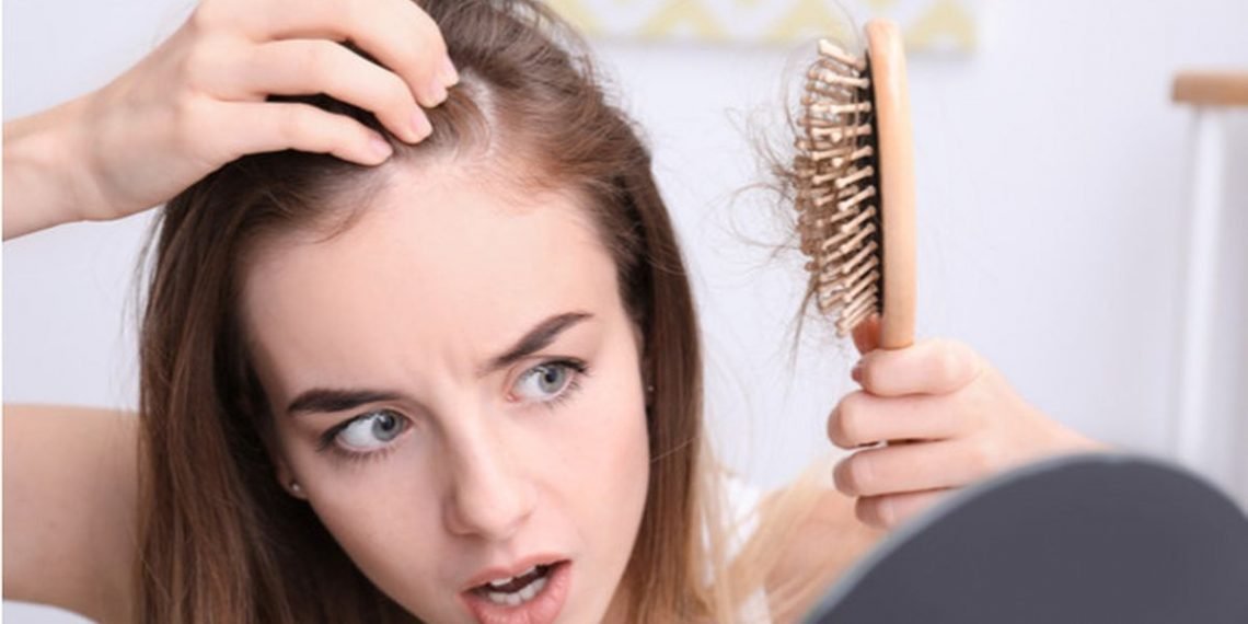 5 Masalah Rambut yang Sering Terjadi_Womanindonesia.jpg