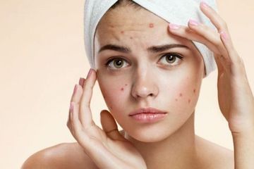 3 Cara Stres Mempengaruhi Kecantikan Anda 4 3 Cara Stres Mempengaruhi Kecantikan Anda_Womanindonesia.jpg