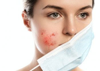 Cara mudah hempas bekas jerawat yang membandel - Womanindonesia.co.id