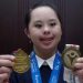 4 Penderita Down Syndrome yang Berprestasi_womanindonesia.jpg