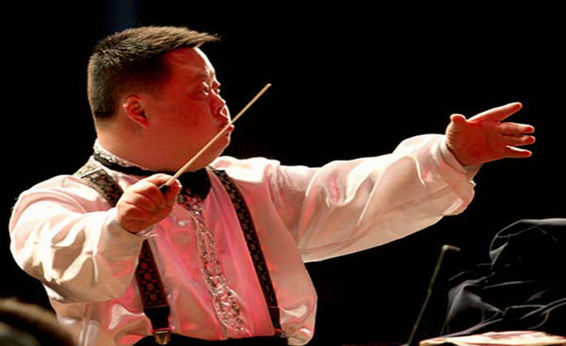 4 Penderita Down Syndrome yang Berprestasi 2 4 Penderita Down Syndrome yang Berprestasi_womanindonesia.jpg