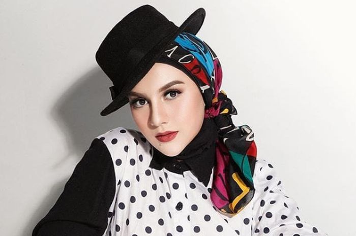 Pernah Dibully, Kini 9 Aktris Ini Semakin Cantik 4 Pernah Dibully, Kini 9 Aktris Ini Semakin Cantik