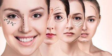 Menua dengan Anggung Melalui Perawatan Injeksi_womanindonesia.jpg