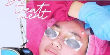 Wow... Picosure Laser Tercanggih di Dunia Hadir di Glafidsya Medika Palembang3_womanindonesia