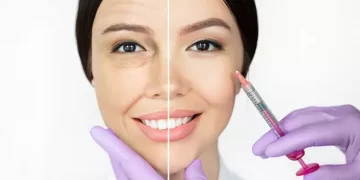 7 Manfaat Suntik Botox Dalam Dunia Kecantikan_womanindonesia.co.id