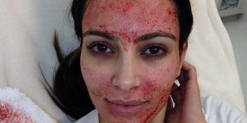 5 Perawatan Kecantikan yang Aneh Ala Aktris Hollywood_womanindonesia.co.id