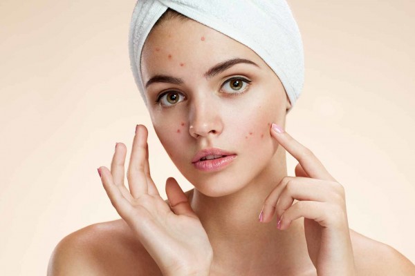 Mengenal 5 Manfaat Zaitun untuk Kecantikan 4 Mengenal 5 Manfaat Zaitun untuk Kecantikan_womanindonesia.co.id