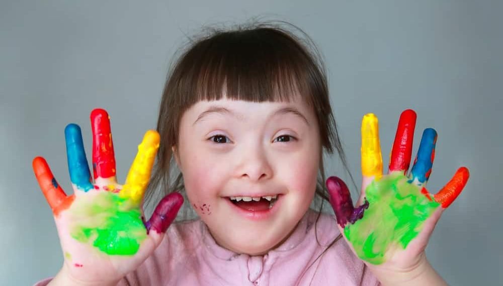 Sejarah Hari Down Syndrome Sedunia 21 Maret_womanindonesia.co.id
