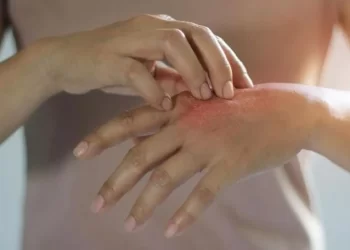 Erha Tawarkan Solusi Kulit Sehat Menyeluruh_womanindonesia.co.id