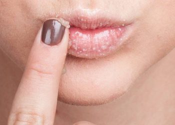 Tips Bibir Kering Agar Sehat Alami_womanindonesia.co.id