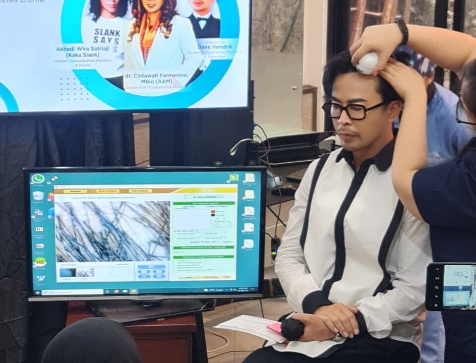 Transplantasi Rambut Metode DHI Terbaik Dunia Hadir di Indonesia 2 Transplantasi Rambut Metode DHI Terbaik Dunia Hadir di Indonesia_womanindonesia.co.id