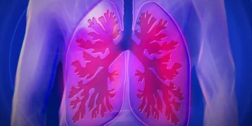 5 Penyakit Kanker yang Sering Menyerang Pria_womanindonesia