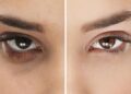 Simak Cara Menghilangkan Kantung Mata dengan 8 Bahan Alami Berikut_womanindonesia.co.id