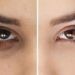 Simak Cara Menghilangkan Kantung Mata dengan 8 Bahan Alami Berikut_womanindonesia.co.id