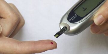 Mengetahui Tanda Tubuh Mengalami Kolesterol Tinggi_womanindonesia.co.id