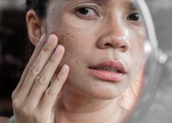 7 Kebiasaan Buruk yang Dapat Merusak Kulit_womanindonesi.co.id