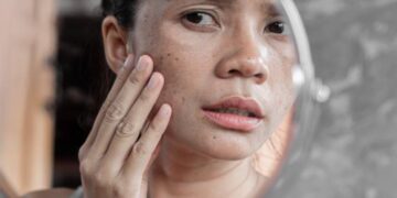 7 Kebiasaan Buruk yang Dapat Merusak Kulit_womanindonesi.co.id