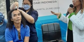 Transplantasi Rambut Metode DHI Terbaik Dunia Hadir di Indonesia_womanindonesia.co.id
