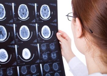 Mengenal Penyakit Gegar Otak dan Efek Sampingnya_womanindonesia.co.id