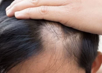 5 Penyebab Rambut Rontok Pada Anak_womanindonesia.co.id