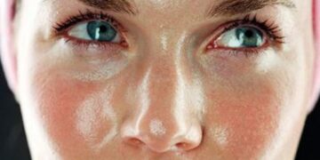 Kulit Wajah Berminyak Apa Penyebabnya?_womanindonesia.co.id