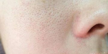 7 Cara Mengecilkan Pori Pori Wajah_womanindonesia.co.id