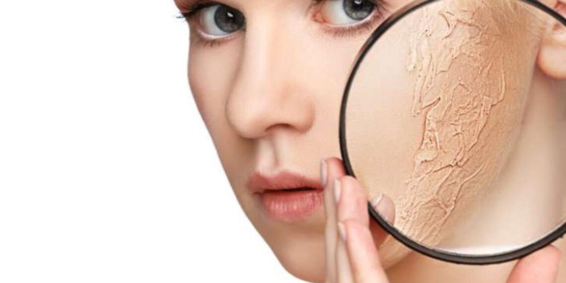 4 Tips Mengatasi Kulit Kering dan Dehidrasi_womanindonesia.co.id