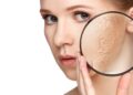 4 Tips Mengatasi Kulit Kering dan Dehidrasi_womanindonesia.co.id
