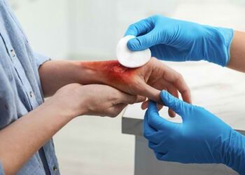 Cara Menangani Pendarahan dan Luka Terbuka_womanindonesia.co.id