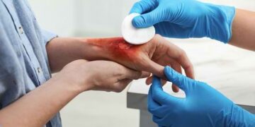 Cara Menangani Pendarahan dan Luka Terbuka_womanindonesia.co.id