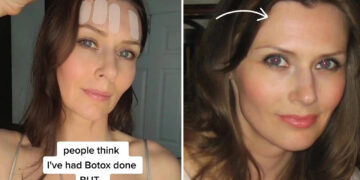 Tanpa Botox, Perempuan 46 Ini Hilangkan Kerutan Pakai Selotip_womanindonesia.co.id