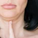 Tips Menghilangkan Double Chin yang Sering Dikeluhkan Perempuan_womanindonesia.co.id