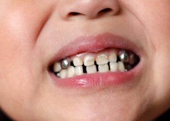 Bahaya Anak Sering Bernapas Lewat Mulut_womanindonesia.co.id