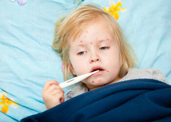 Kasus Campak Melonjak 2 Kali Lipat - Womanindonesia.co.id