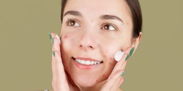 Cara Mengatasi Jerawat dengan Manfaat Natural Sulfur dan BHA_womanindonesia.co.id