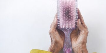 Penyakit Alopecia - Womanindonesia.co.id