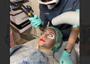Menolak Tua dengan Treatment Hollywood Spectra 3 Treatment Hollywood Spectra Menolak Tua - Womanindonesia.co.id