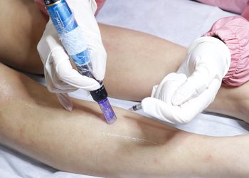 5 Cara Menghilangkan Bekas Luka Membandel_Womanindonesia.co.id