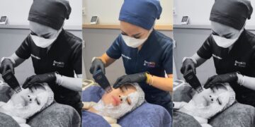 Morpheus 8, Teknologi Pengencangan Kulit Favorit Hollywood _womanindonesia.co.id